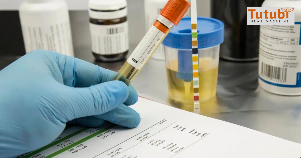 Abalos sa BSKE candidates Magpadrug test Tutubi News Magazine