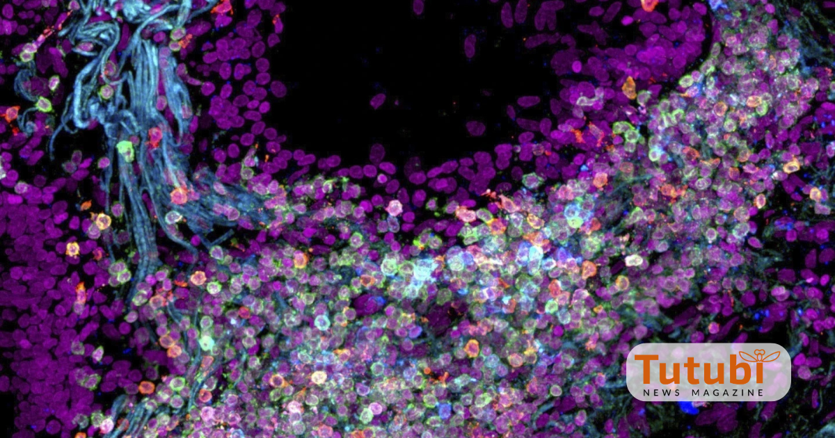 Mapping The Human Body: Scientists Chart Cells To Unlock Health Secrets 